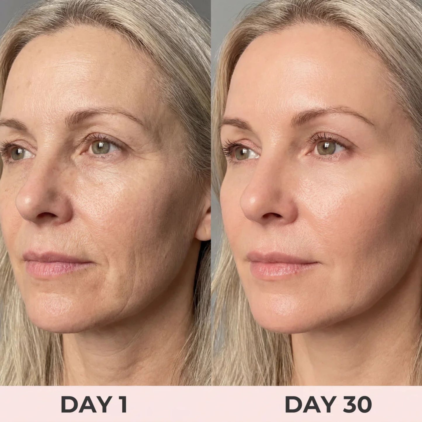 7-in-1 LED Face & Neck Sculptor