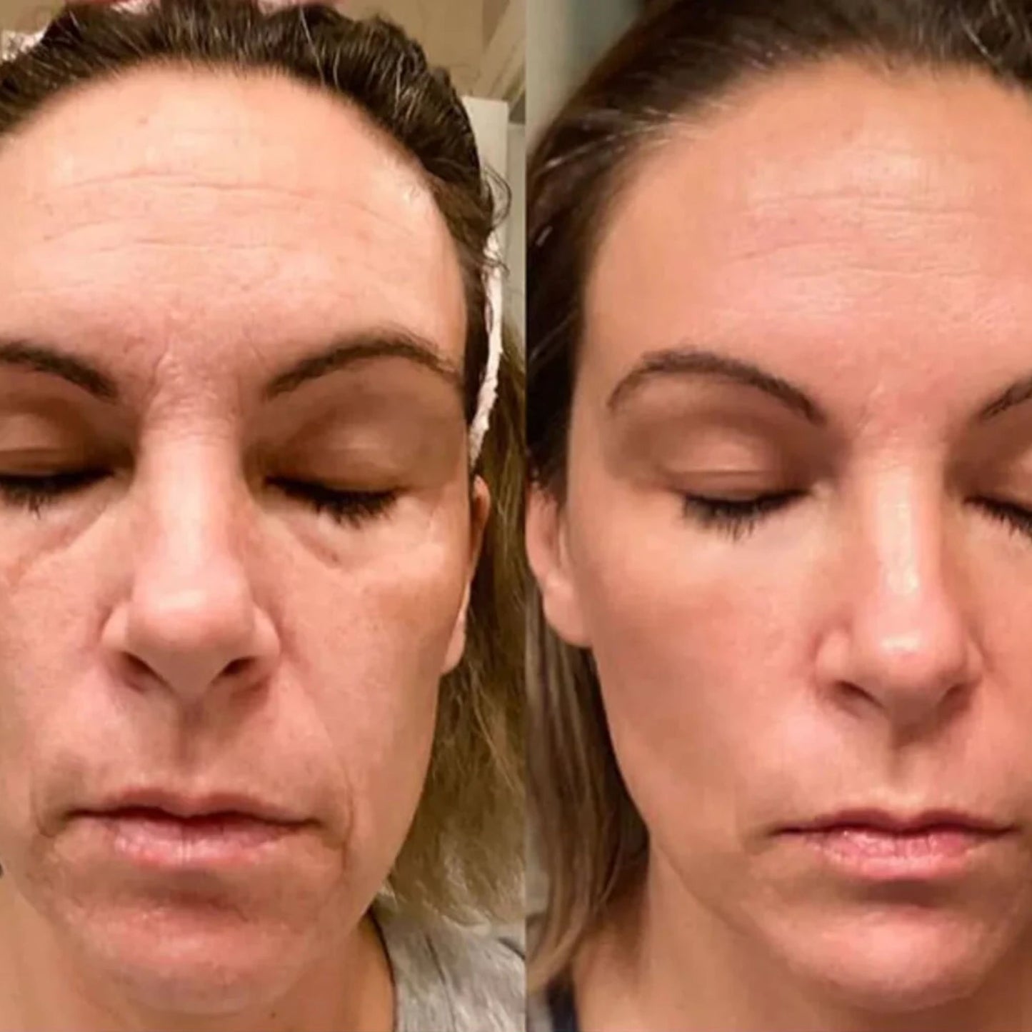 7-in-1 LED Face & Neck Sculptor